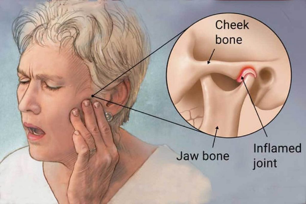 JAMSS Jaw and check bone pain solutions