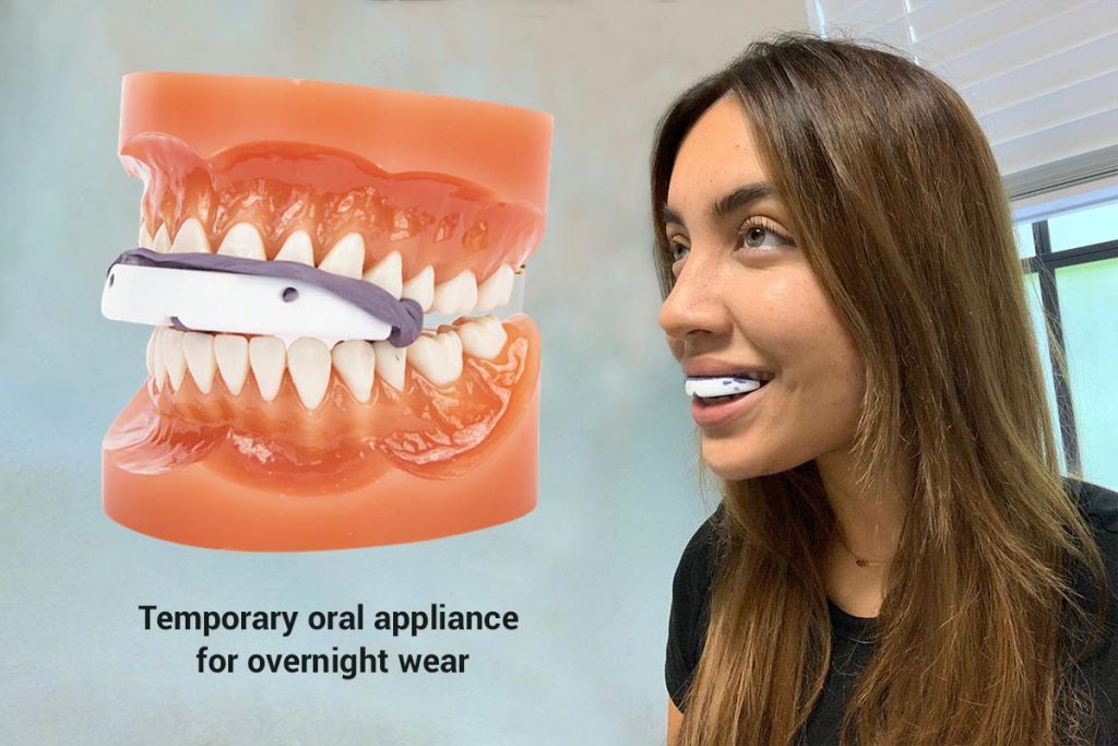Deliver a temporary oral appliance to the patient for overnight wear