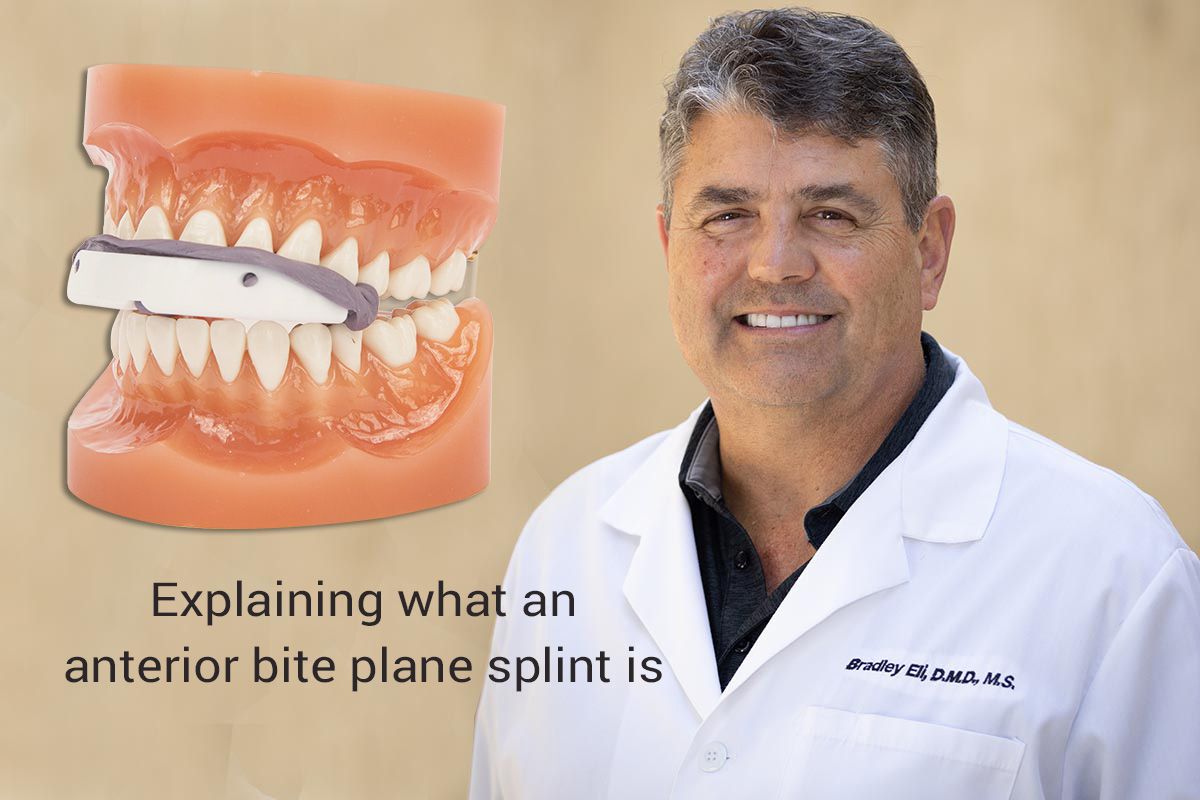 What are Anterior Bite Plane Splints?