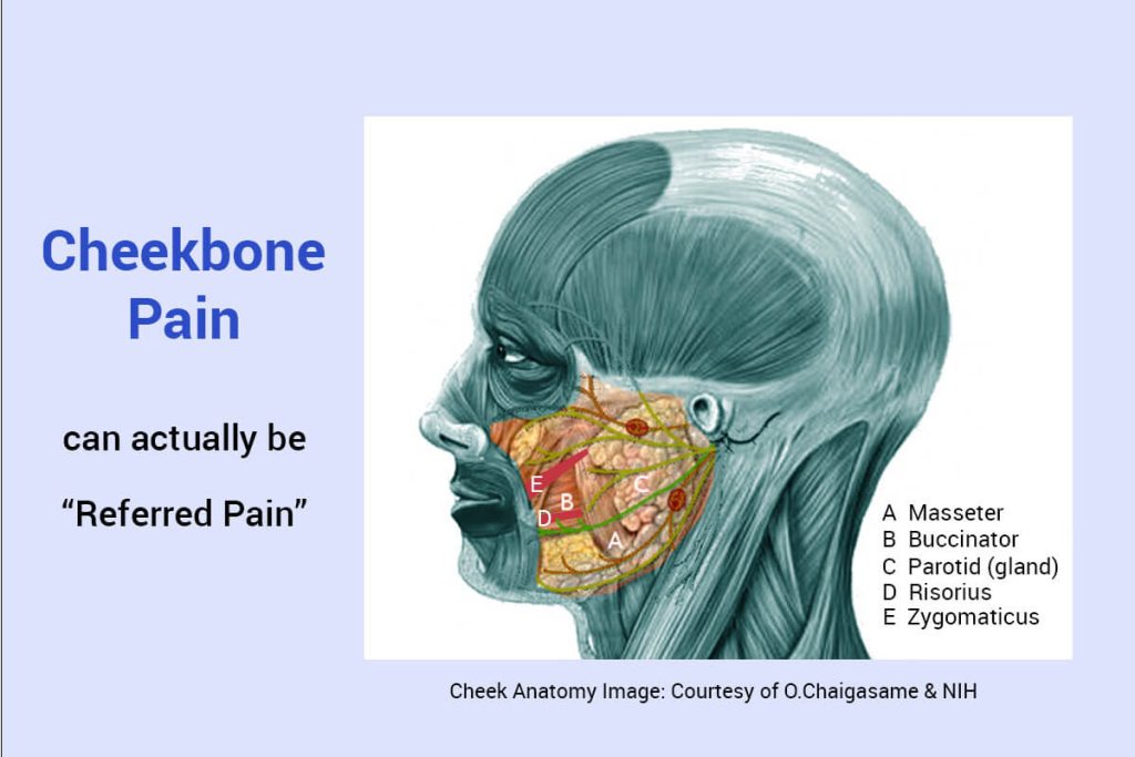 Checkbone pain can be referred pain
