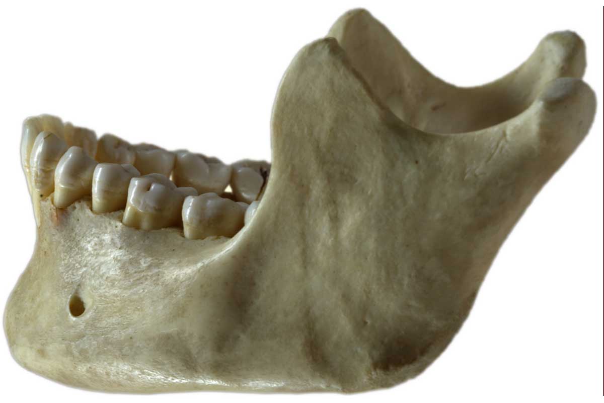 A human's lower left jaw bone